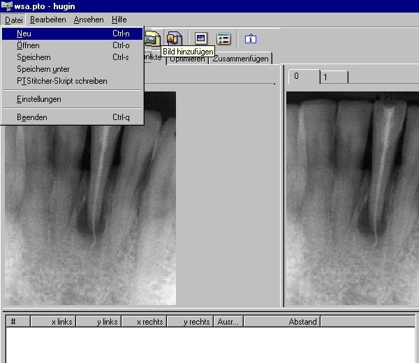 HugIn neues Projekt und Laden der Rntgenbilder